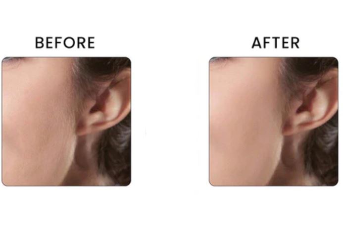 Mini Electric Hair Remover
