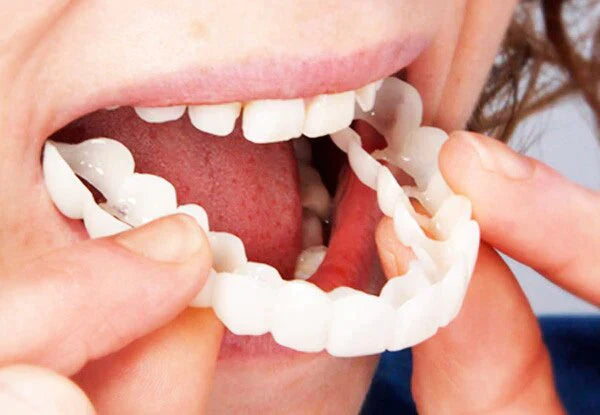 FITFLEX DENTURES