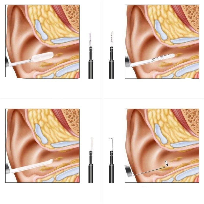 Live Ear Medicinal ear endoscope.
