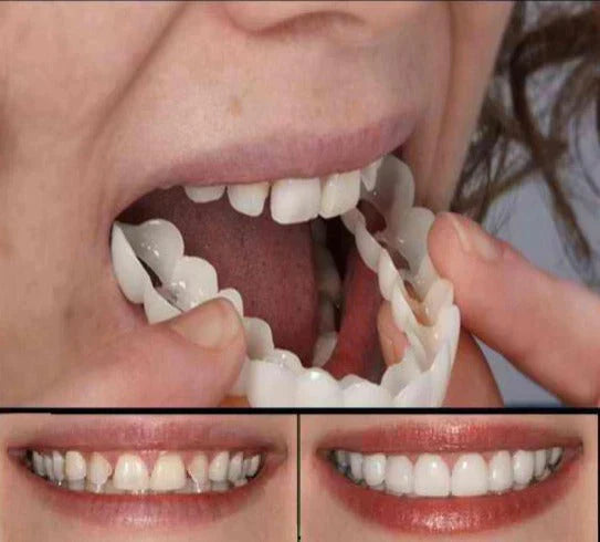 FITFLEX DENTURES