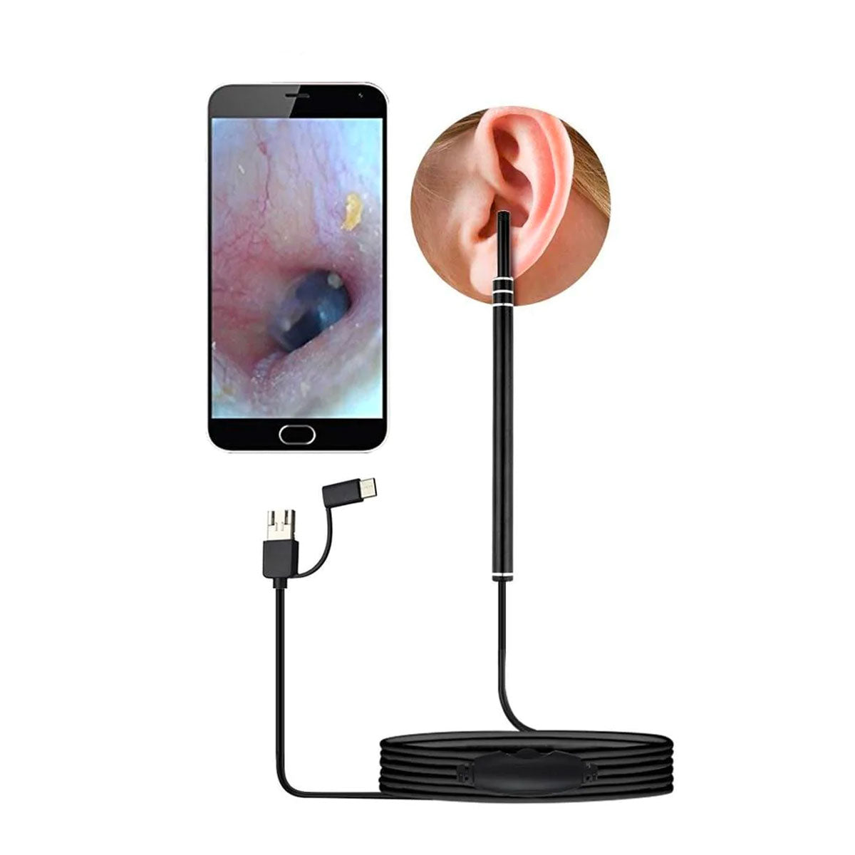 Live Ear Medicinal ear endoscope.